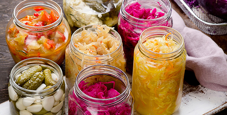Examples of fermented foods including yogurt, kimchi, sauerkraut, and kefir